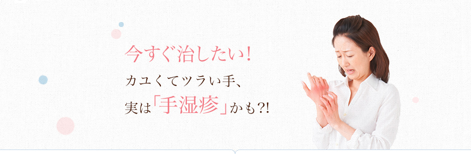 今すぐ治したい!カユくてツラい手、実は「手湿疹」かも?!