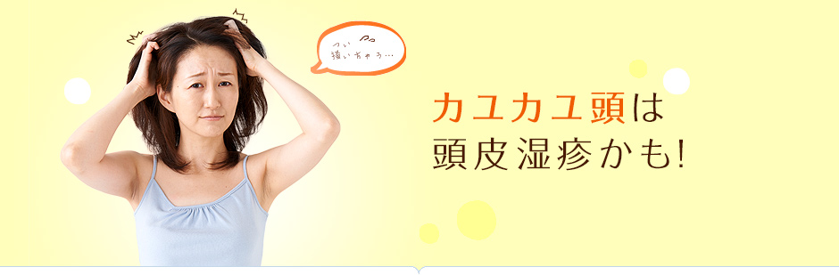 カユカユ頭は頭皮湿疹です!