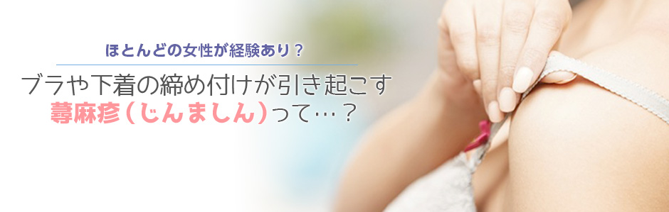 ほとんどの女性が経験あり!?ブラや下着の締め付けが引き起こす蕁麻疹(じんましん)って…?