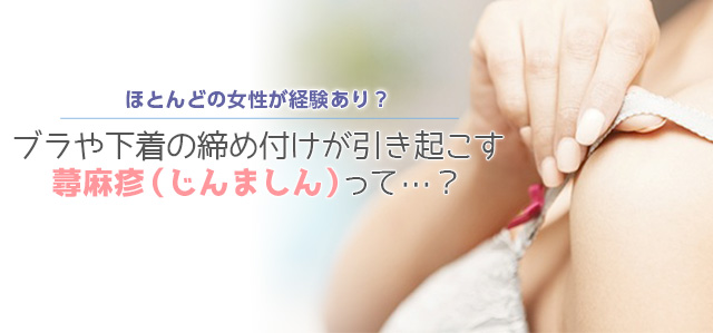 ほとんどの女性が経験あり!?ブラや下着の締め付けが引き起こす蕁麻疹(じんましん)って…?