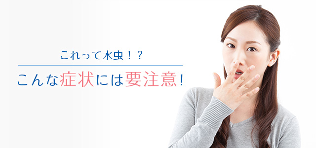 これって水虫!?こんな症状には要注意!