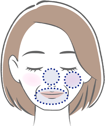顔のイラスト（頬、鼻の周り、口の周りにがさがさ、粉ふき、皮めくれがよく出ます）