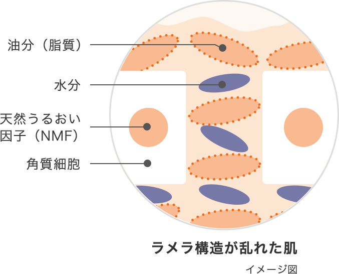 ラメラ構造が乱れた肌（イメージ図）：油分（脂質）、水分、天然うるおい因子（NMF）、角質細胞