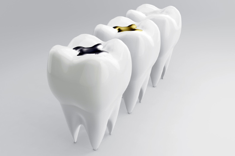 湿疹（皮膚炎）について