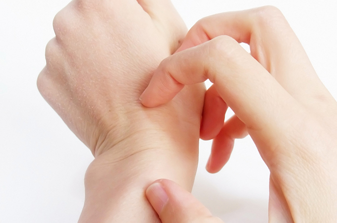 手湿疹と似た皮膚疾患