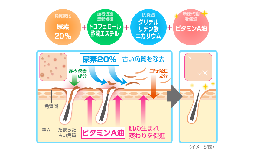 尿素20%+トコフェロール+グリチルリチン酸二カリウム+ビタミンA油