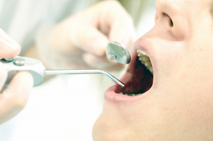 歯槽膿漏の治療（改善）方法
