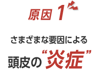 原因1 さまざまな要因による頭皮の“炎症”