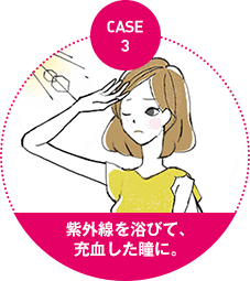 case3：紫外線を浴びて、 充血した瞳に。