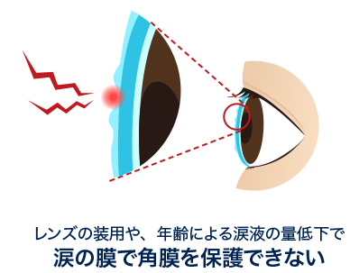 レンズの装用や、年齢による涙液の量低下で 涙の膜で角膜を保護できない