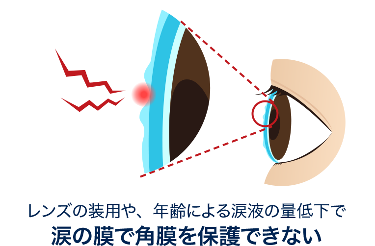 レンズの装用や、年齢による涙液の量低下で 涙の膜で角膜を保護できない