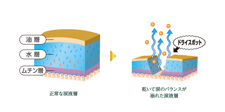 正常な涙液層 → 乾いて涙のバランスが崩れた涙液層