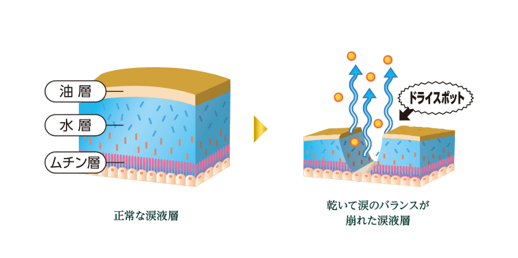 Vロートドライアイプレミアム | ロート製薬: 商品情報サイト