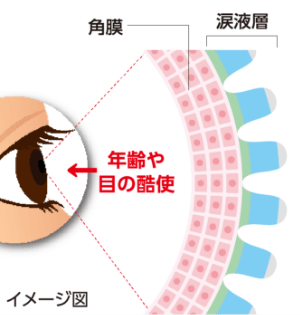 年齢や目の酷使などにより、目の表面（角膜）を覆う涙液層のバランスが崩れると、角膜が露出した状態になるため、負担を受けやすくなります。