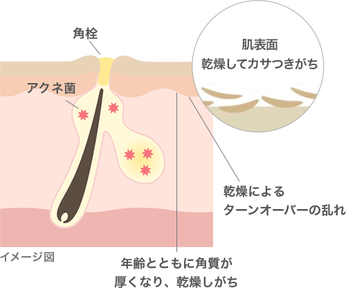 イメージ図：皮膚の断面図